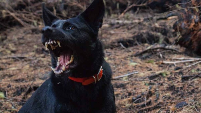 Woman Survives Terrifying Dog Attack, Leading to Leg Amputation - Her Brave Actions Will Leave You Speechless!